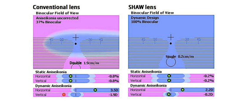 Shaw Lens